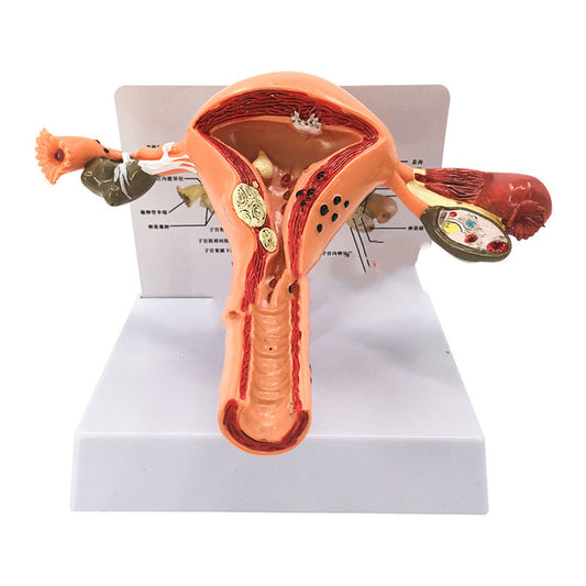 Female Pathological Uterus Model Female Maternal Uterus Structure Anatomy - Metatron Store