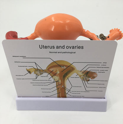Female Pathological Uterus Model Female Maternal Uterus Structure Anatomy - Metatron Store