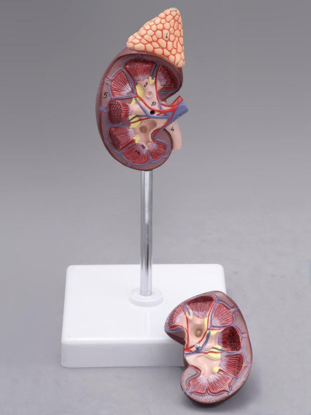 Kidney Anatomy With Adrenal Gland Model - Metatron Store