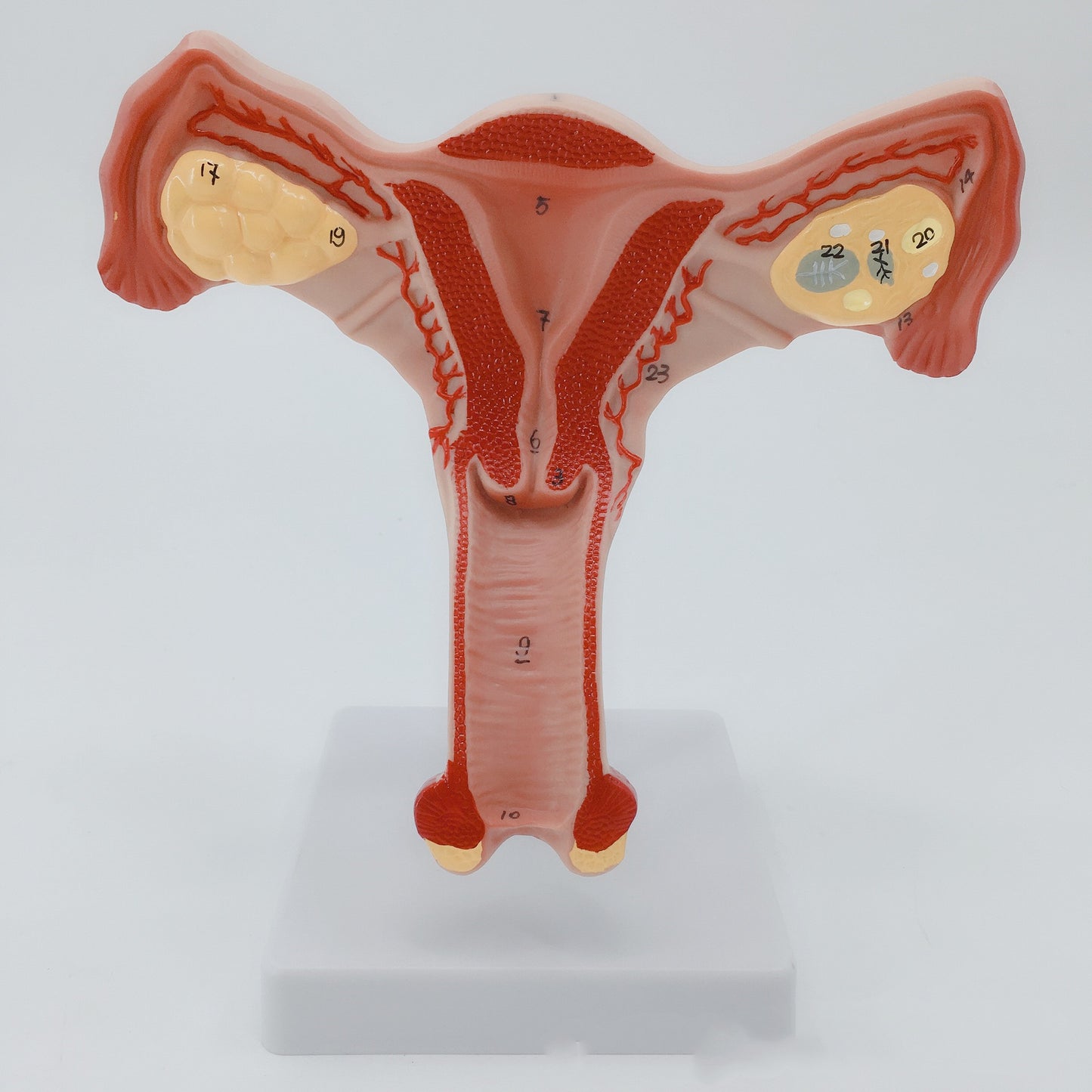 Female Pathological Uterus Model Female Maternal Uterus Structure Anatomy - Metatron Store