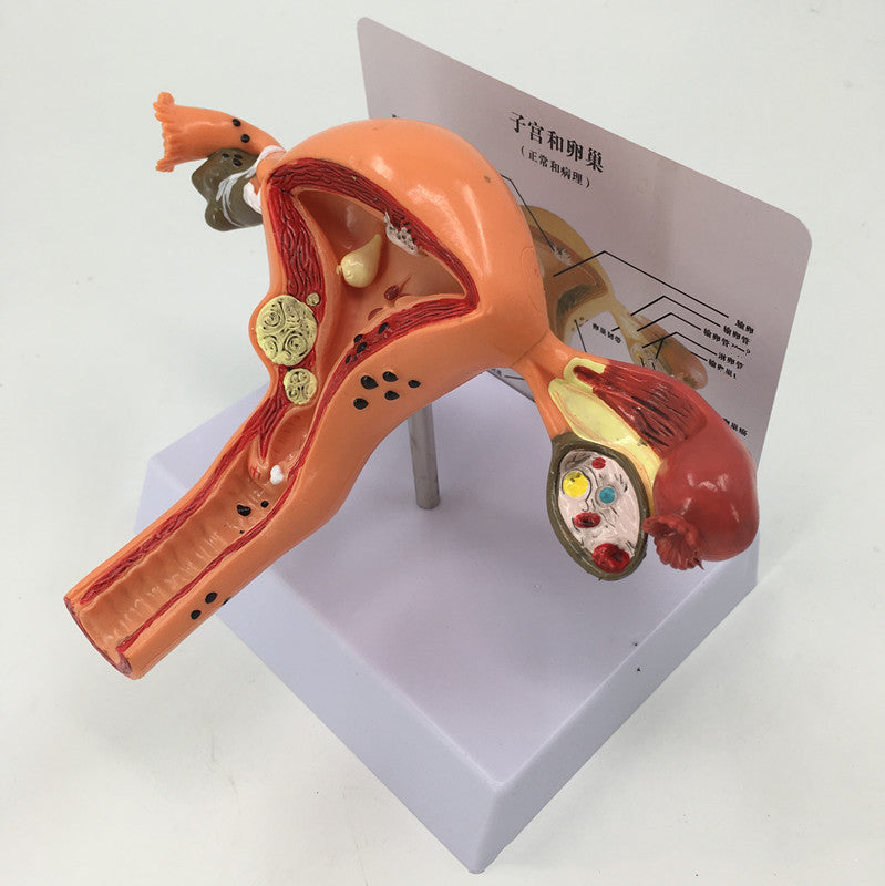 Female Pathological Uterus Model Female Maternal Uterus Structure Anatomy - Metatron Store